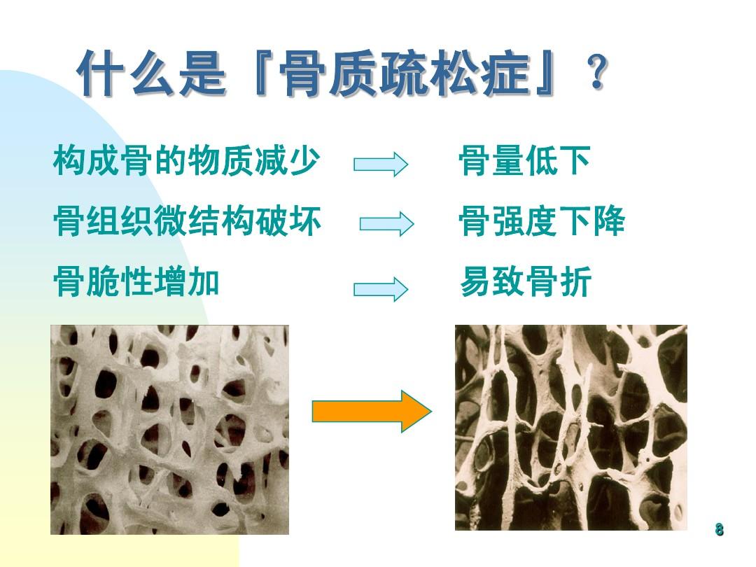 骨質(zhì)疏松，可不能一“鈣”而論